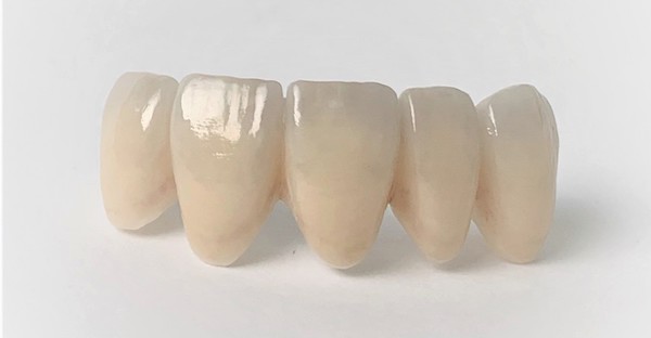 京橋 銀座みらい歯科で歯科治療に使用する高い技術による表面加工をされたジルコニアの被せ物のイメージ
