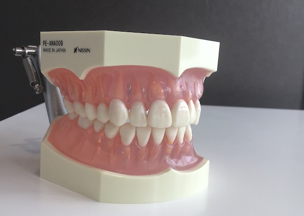 京橋 銀座みらい歯科＿健康な白い歯とピンク色の歯茎の両顎の模型