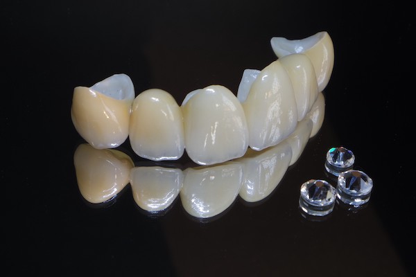 京橋 銀座みらい歯科で歯科治療に使用するセラミック素材ジルコニアのイメージ