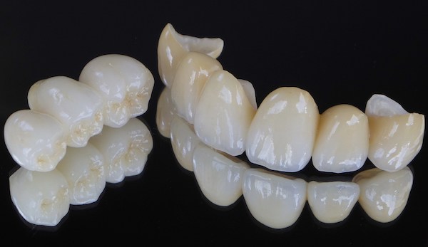 京橋 銀座みらい歯科で歯科治療に使用するセラミック素材ジルコニアの前歯と奥歯の被せ物のイメージ