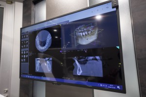 京橋・銀座の歯医者_京橋 銀座みらい歯科 ブログ＿インプラント治療の診断について_院内で撮影できるCTを大きなモニターに写した診療室