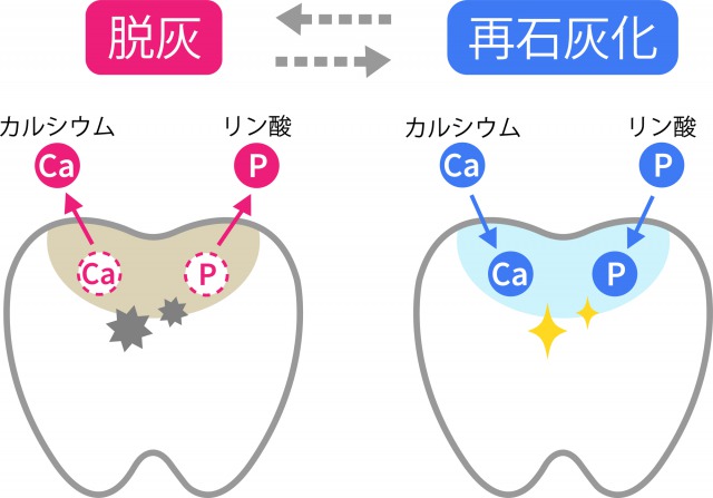 京橋 銀座みらい歯科院長コラム｜口腔内PH値と唾液のはたらき｜脱灰と再石灰化の模式図