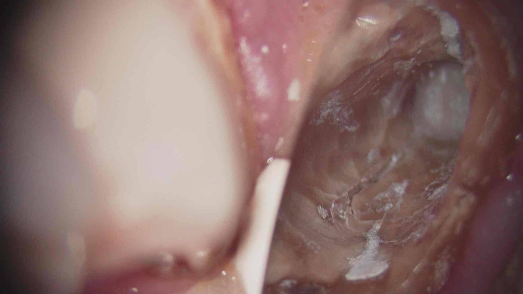 京橋 銀座みらい歯科院長コラム｜歯の神経「歯髄」の処置について｜口腔内の画像