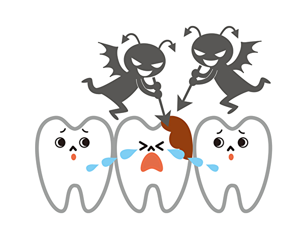 京橋 銀座みらい歯科｜ブログ｜虫歯になる原因と、虫歯の予防法について徹底解説｜虫歯の画像
