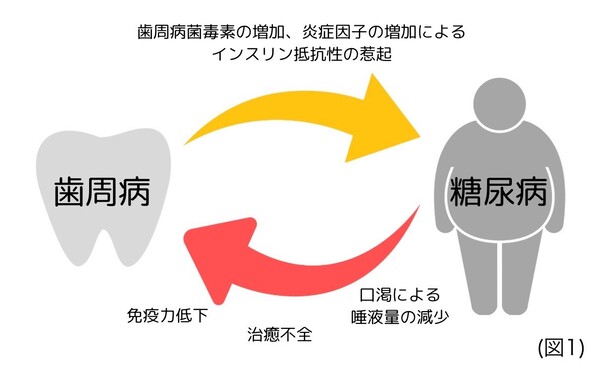 京橋 銀座みらい歯科｜歯科衛生士ブログ｜歯周病と糖尿病の意外な関係について｜画像2
